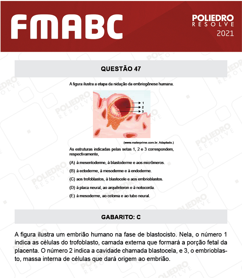 Questão 47 - Fase única - FMABC 2021