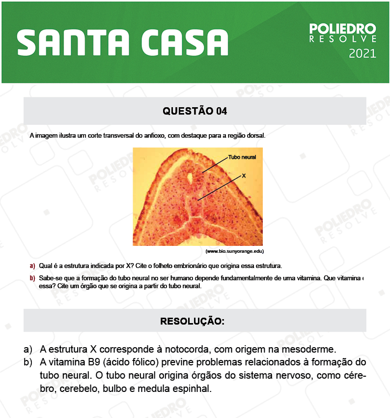 Dissertação 4 - 2º Dia - SANTA CASA 2021