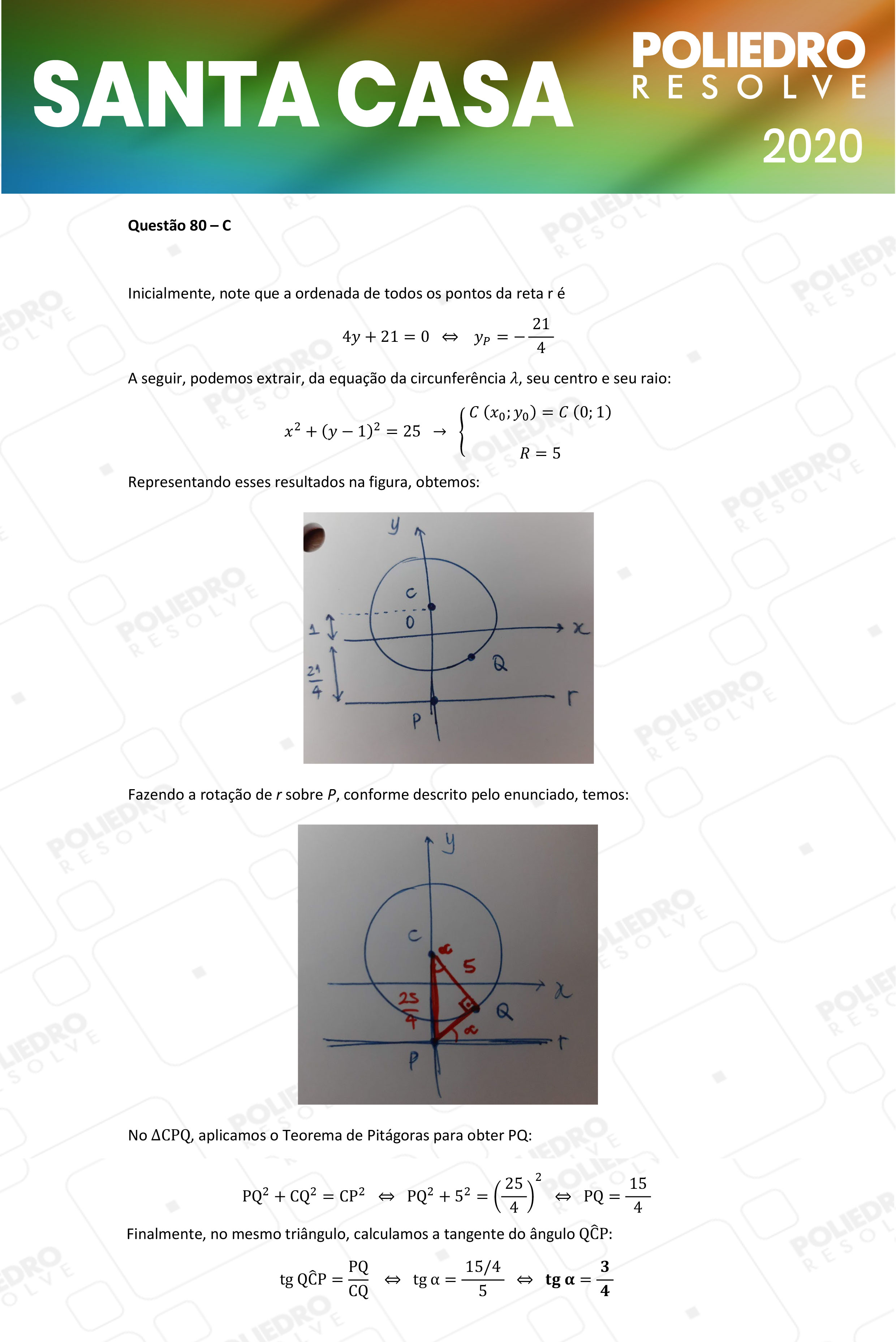 Questão 80 - 2º Dia - SANTA CASA 2020