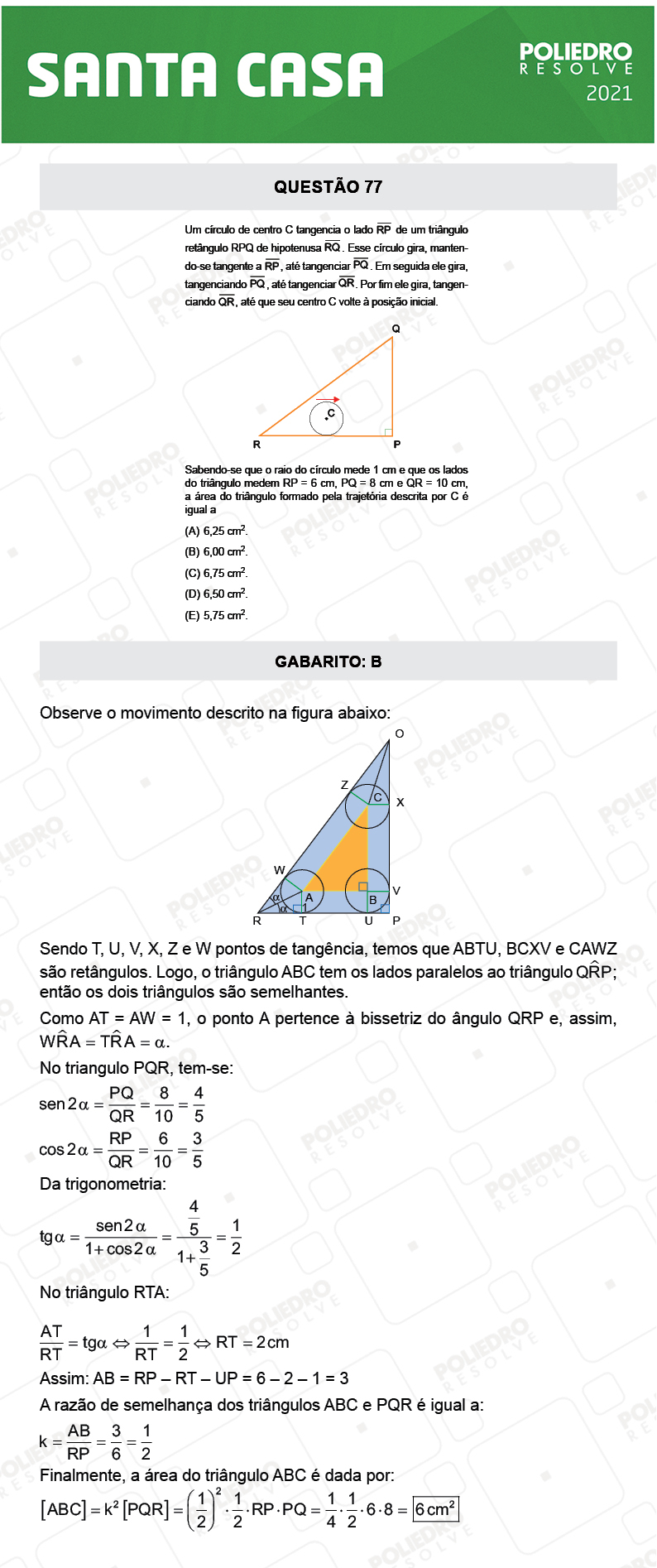 Questão 77 - 1º Dia - SANTA CASA 2021