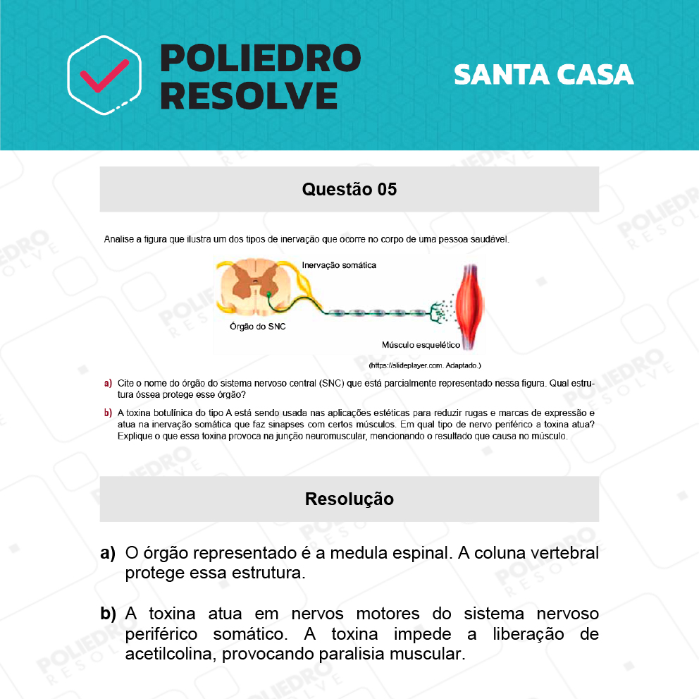 Dissertação 5 - 2º Dia - SANTA CASA 2022