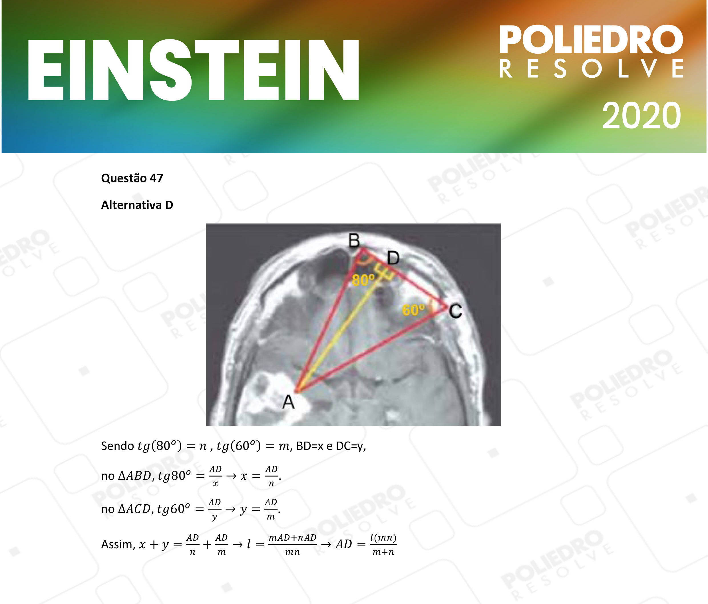 Questão 47 - Fase única - EINSTEIN 2020